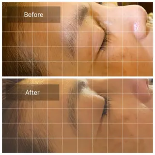 アイブロウ 肌改善専門 浦和美園のエステ・リラクイメージ