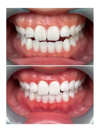 ホワイトニングジム 池袋のその他イメージ