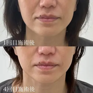 BeautyLounge relle所属・relle (リル)のネイルデザイン