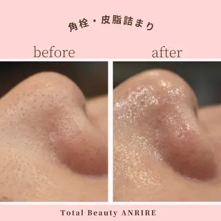 ANRIRE (アンリール)のエステ・リラクイメージ