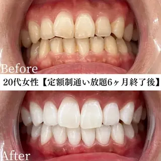 メンズ キッズ セルフホワイトニング専門店WHITE福岡天神店所属・セルフホワイト専門店 WHITE福岡天神店のエステ・リラクイメージ