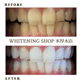 メンズ ホワイトニング ショップ本厚木のその他イメージ