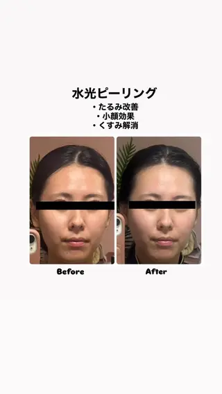 脱毛サロン エクボスタッフのエステ・リラクイメージ