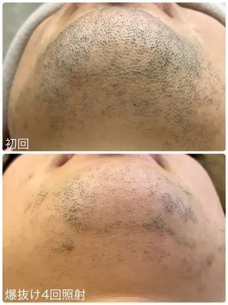 Hisui 小出のエステ・リラクイメージ