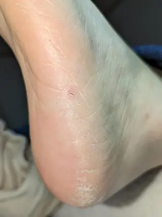 carenail　 tsugumiのその他イメージ