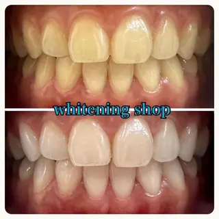 ホワイトニング ショップ吉祥寺店のエステ・リラクイメージ