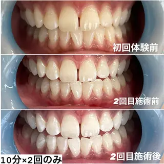 ホワイトニング専門店 Hi-Whiteのその他イメージ