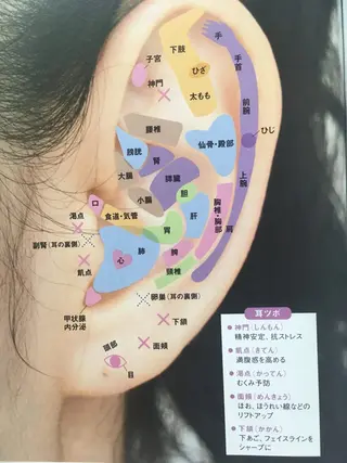 美楽鍼 びらくしんのその他イメージ