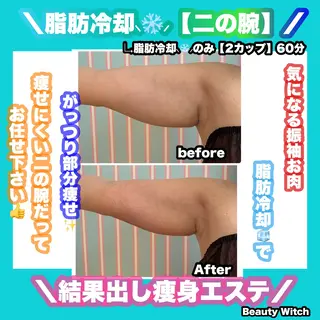 痩身/脱毛/ネイル HARUKAのエステ・リラクイメージ