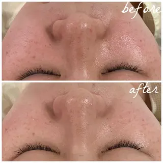 メンズ メナード岐阜市茜部 杉浦のエステ・リラクイメージ