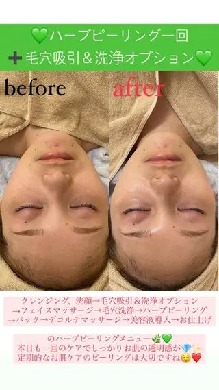 メンズ Salon de Lino 御器所のエステ・リラクイメージ