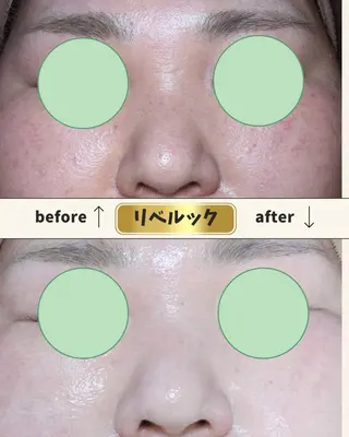 コンセプトサロン友 木下のエステ・リラクイメージ