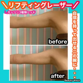 痩身/脱毛/ネイル HARUKAのエステ・リラクイメージ