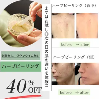 💠mariange💠(脱毛・ハーブピーリング)所属・mariange 〜美肌・美容脱毛〜のエステ・リラクイメージ