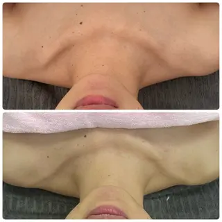 Salon Rion所属・Rion 野々村のエステ・リラクイメージ