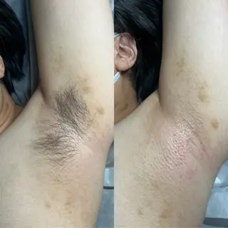 脱毛サロンMIRUDA所属・脱毛サロン MIRUDAのエステ・リラクイメージ