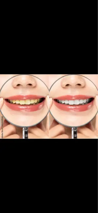 WHITENING ハウスのマツエク・マツパデザイン