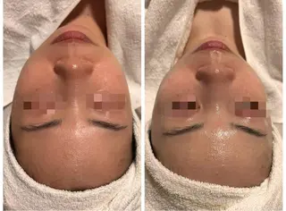 lumirise所属・lumi riseのエステ・リラクイメージ