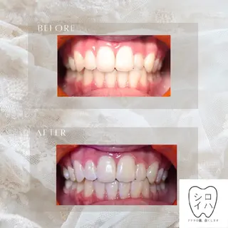 ホワイトニングサロン シロイハ所属・歯を白くしたい方🦷 シロイハのその他イメージ