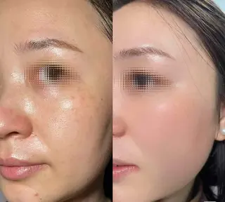 マツエク・マツパ aliaハイフ&水光ジェットサロン所属・aliaハーブ水光店 エステティシャン募集のエステ・リラクイメージ