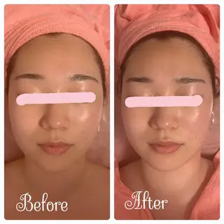 透明感の肌Lino malieのエステ・リラクイメージ