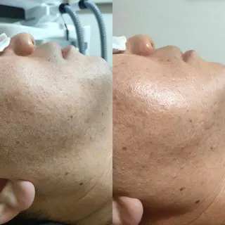 メンズ 武 藤のエステ・リラクイメージ