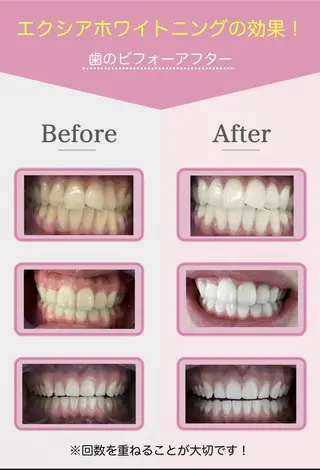 セルフホワイトニング エクシア大阪梅田店のその他イメージ