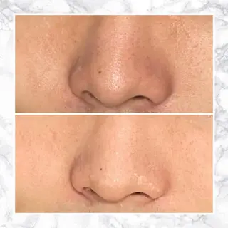 セミロング カラー パーマ ヘアアレンジ メンズ キッズ ネイル マツエク・マツパ アイブロウ 触れたくなる モテ肌へ...❤︎のエステ・リラクイメージ