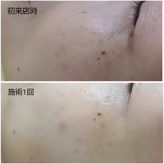 シミケア専門店 HAQUAのその他イメージ