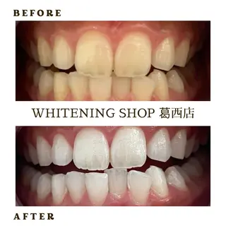 メンズ ホワイトニング ショップ葛西店のその他イメージ