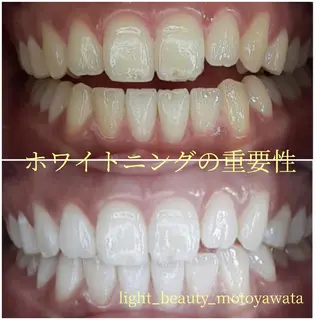 五十嵐 蓮のその他イメージ