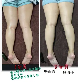 LOMILOMI Naoのエステ・リラクイメージ