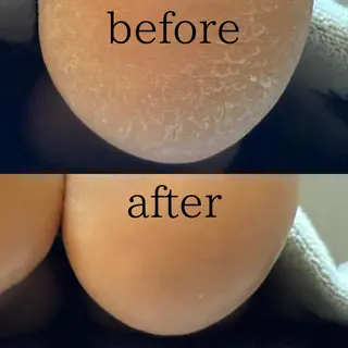 メンズ 脱毛サロン Terry所属・脱毛サロン Terryのエステ・リラクイメージ