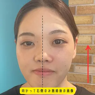 Nexfit for Beauty小顔矯正のエステ・リラクイメージ