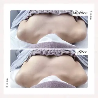 【バスト専門店 】 Kiana のエステ・リラクイメージ