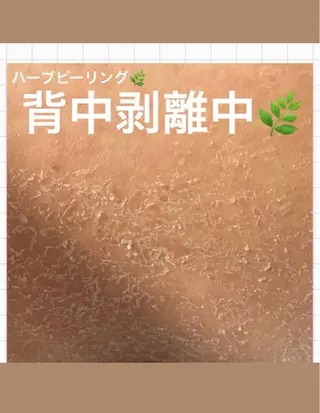 メンズ ハーブピーリング 専門店MOKA所属・ハーブピーリング専門 MOKAのエステ・リラクイメージ