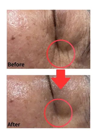 Belle White所属・本格痩身＊透明美肌 BelleWhiteのエステ・リラクイメージ