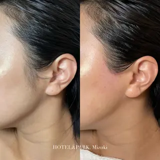 HOTEL&PARK . ワックス脱毛のエステ・リラクイメージ