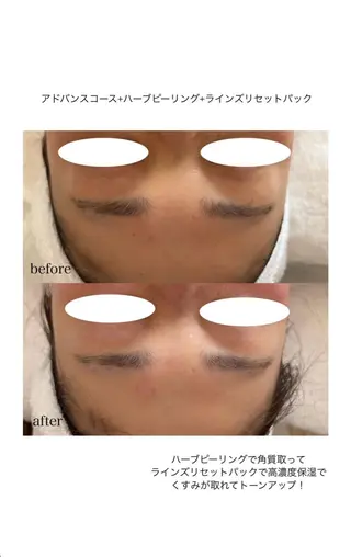 メナードフェイシャルサロン 熊本インター西店所属・フェイシャルエステ 🎀 naoのエステ・リラクイメージ