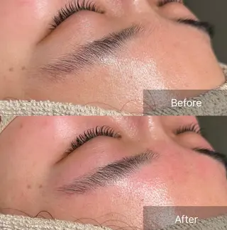 アイブロウ for woman所属・森 美優のエステ・リラクイメージ