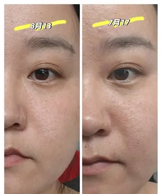 カラー aliaハイフ&水光ジェットサロン所属・aliaハーブ水光店 エステティシャン募集のエステ・リラクイメージ