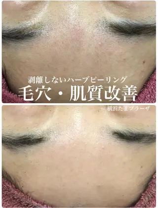 LILIANA所属・LILIANA ☆YURIのエステ・リラクイメージ