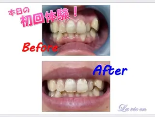 セルフホワイトニングサロン　ラヴィアン所属・ホワイトニングサロン La vie enのその他イメージ