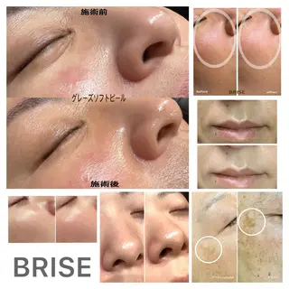 BRISE ブライズのエステ・リラクイメージ