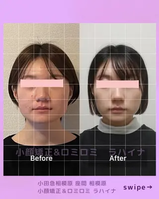 小顔矯正＆ロミロミ ラハイナ所属・小顔矯正 ラハイナのエステ・リラクイメージ