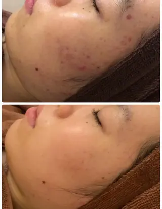 ミディアム カラー パーマ ヘアアレンジ メンズ キッズ ネイル マツエク・マツパ アイブロウ 肌質体質を変えて すっぴん肌にのエステ・リラクイメージ