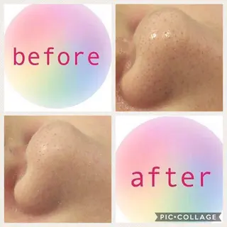 ミディアム カラー パーマ ヘアアレンジ メンズ キッズ ネイル マツエク・マツパ ニキビ・肌質改善専門 ♡人生が変わるサロンのエステ・リラクイメージ