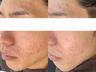 Belle beauty salon所属・Bellebeau tysalonのエステ・リラクイメージ