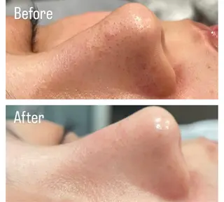 アンド ミルルのエステ・リラクイメージ