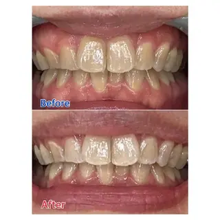 MBEAUTYSALON 千葉店・京成大久保所属・Melty 輝のその他イメージ